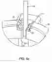 Fig. 07 - Methods and devices for taking multiple biopsy samples from the esophagus