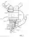 Fig. 02 - Method for use of attachment device and system for corneal irrigating cannula