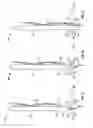 Fig. 06 - Needle-electrode and tissue anchor system