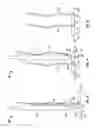 Fig. 07 - Needle-electrode and tissue anchor system
