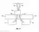 Fig. 08 - Needle-electrode and tissue anchor system