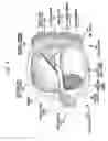 Fig. 07 - Electroneural interface for a medical implant