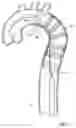 Fig. 08 - Curvable stent-graft and apparatus and fitting method