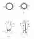 Fig. 02 - IMPROVEMENTS IN AND RELATING TO MEDICAL DEVICES