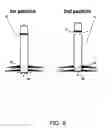 Fig. 07 - Re-inflatable inner tube