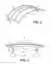 Fig. 03 - Device for maintaining and depositing a thermoplastic composite material on a shaping tool and method for making a composite part