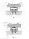 Fig. 02 - Loading device for a shoe press roll