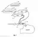 Fig. 02 - Respiratory profile parameter determination method and apparatus