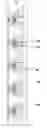 Fig. 01 - Condensing element, array, and methods thereof