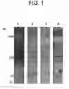 Fig. 02 - Determination of AM-binding proteins and the association of adrenomedullin (AM) therewith