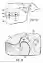 Fig. 02 - Musculoskeletal repositioning device