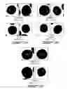 Fig. 10 - RELIABLE DETECTION OF VANCOMYCIN-INTERMEDIATE STAPHYLOCOCCUS AUREUS