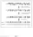 Fig. 02 - Methods for determination of haplotype dissection