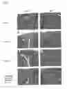Fig. 02 - Candidates against infection