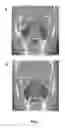 Fig. 02 - NASAL SPRAY COMPOSITION AND METHOD FOR TREATING RHINITIS, SINUSITIS OR BOTH