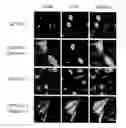 Fig. 01 - REDUCTION OF POLYALANINE-INDUCED PROTEIN AGGREGATES AND TOXICITY BY UBIQUILIN