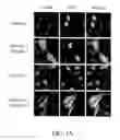 Fig. 02 - REDUCTION OF POLYALANINE-INDUCED PROTEIN AGGREGATES AND TOXICITY BY UBIQUILIN