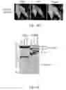 Fig. 03 - REDUCTION OF POLYALANINE-INDUCED PROTEIN AGGREGATES AND TOXICITY BY UBIQUILIN