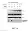 Fig. 09 - REDUCTION OF POLYALANINE-INDUCED PROTEIN AGGREGATES AND TOXICITY BY UBIQUILIN