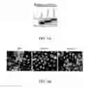 Fig. 10 - REDUCTION OF POLYALANINE-INDUCED PROTEIN AGGREGATES AND TOXICITY BY UBIQUILIN