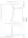 Fig. 07 - Levodopa prodrug mesylate hydrate