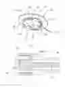 Fig. 06 - Operating instrument for a height-adjustable spinal implant