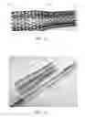 Fig. 06 - Apparatus and method for treating occluded infection collections of the digestive tract