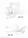 Fig. 02 - Device and method for correcting a spinal deformity