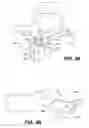 Fig. 04 - Device and method for correcting a spinal deformity