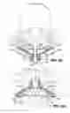 Fig. 06 - Device and method for correcting a spinal deformity