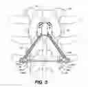 Fig. 07 - Device and method for correcting a spinal deformity