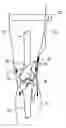 Fig. 01 - Post-operative pain inhibitor for joint replacement and method thereof