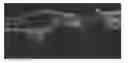 Fig. 01 - Method of oscillatory thermotherapy of biological tissue