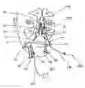 Fig. 01 - Devices, systems and methods for diagnosing and treating sinusitus and other disorder of the ears, nose and/or throat