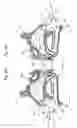 Fig. 06 - Devices, systems and methods for diagnosing and treating sinusitus and other disorder of the ears, nose and/or throat
