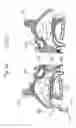 Fig. 08 - Devices, systems and methods for diagnosing and treating sinusitus and other disorder of the ears, nose and/or throat