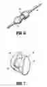 Fig. 05 - Swellable interspinous stabilization implant