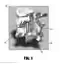 Fig. 06 - Swellable interspinous stabilization implant