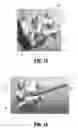 Fig. 09 - Swellable interspinous stabilization implant