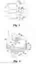 Fig. 02 - Intervertebral Disc Prosthesis Having Viscoelastic Properties