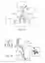 Fig. 02 - Elongated lung volume reduction devices, methods, and systems