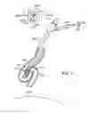 Fig. 40 - Elongated lung volume reduction devices, methods, and systems