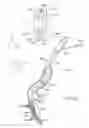 Fig. 41 - Elongated lung volume reduction devices, methods, and systems