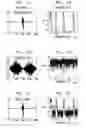 Fig. 02 - Effective deployment of temporal noise shaping (TNS) filters