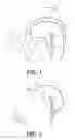 Fig. 02 - LEARNING ANATOMY DEPENDENT VIEWING PARAMETERS ON MEDICAL VIEWING WORKSTATIONS