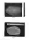 Fig. 03 - Mango tree FP2