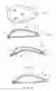 Fig. 02 - Human limb/joint protective pad and method of making