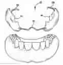 Fig. 01 - COSMETIC PROSTHESIS AND METHODS FOR MAKING THE SAME