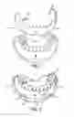 Fig. 02 - COSMETIC PROSTHESIS AND METHODS FOR MAKING THE SAME