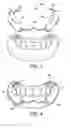 Fig. 03 - COSMETIC PROSTHESIS AND METHODS FOR MAKING THE SAME